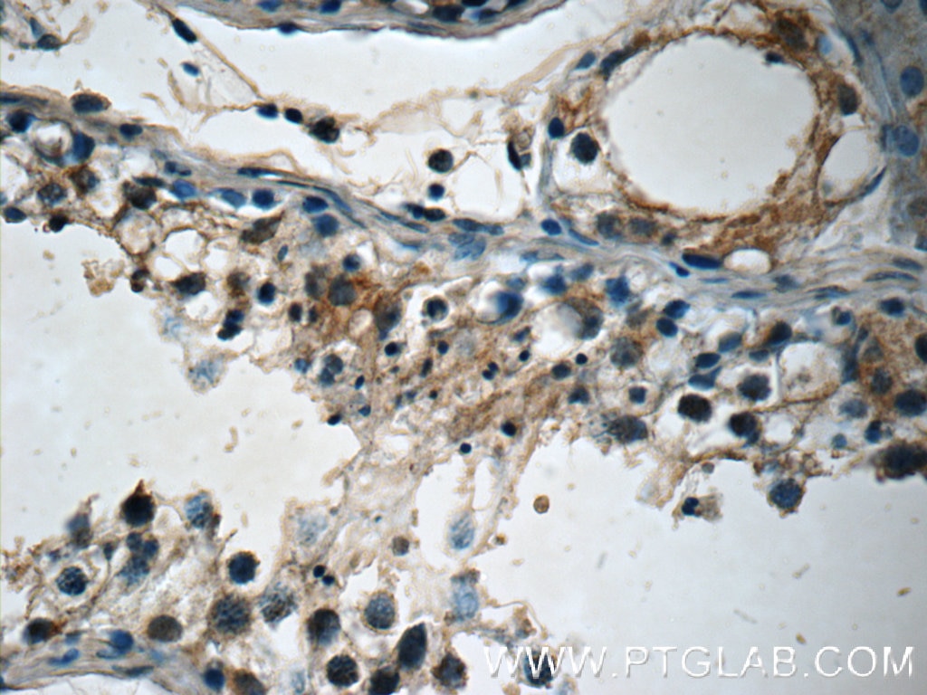 Immunohistochemistry (IHC) staining of human testis tissue using ETF1 Polyclonal antibody (10884-1-AP)
