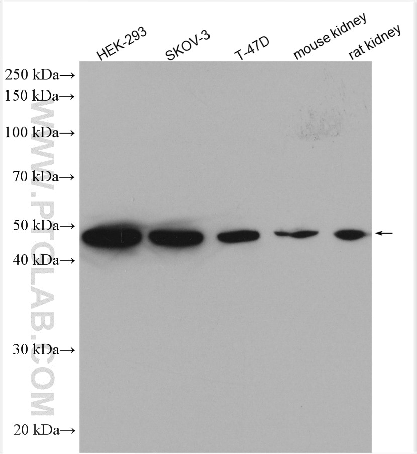 Western Blot (WB) analysis of various lysates using ETF1 Polyclonal antibody (10884-1-AP)