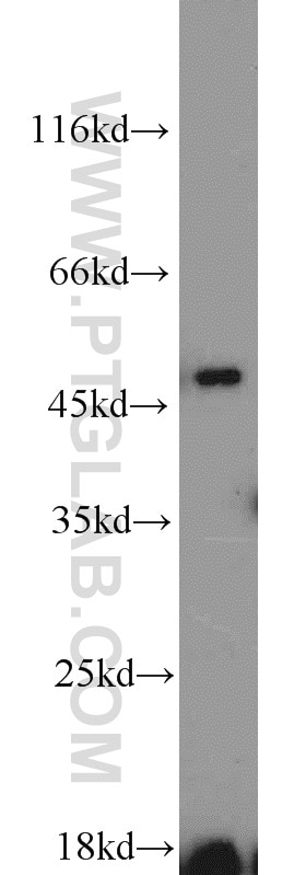 Western Blot (WB) analysis of mouse testis tissue using ETF1 Polyclonal antibody (10884-1-AP)