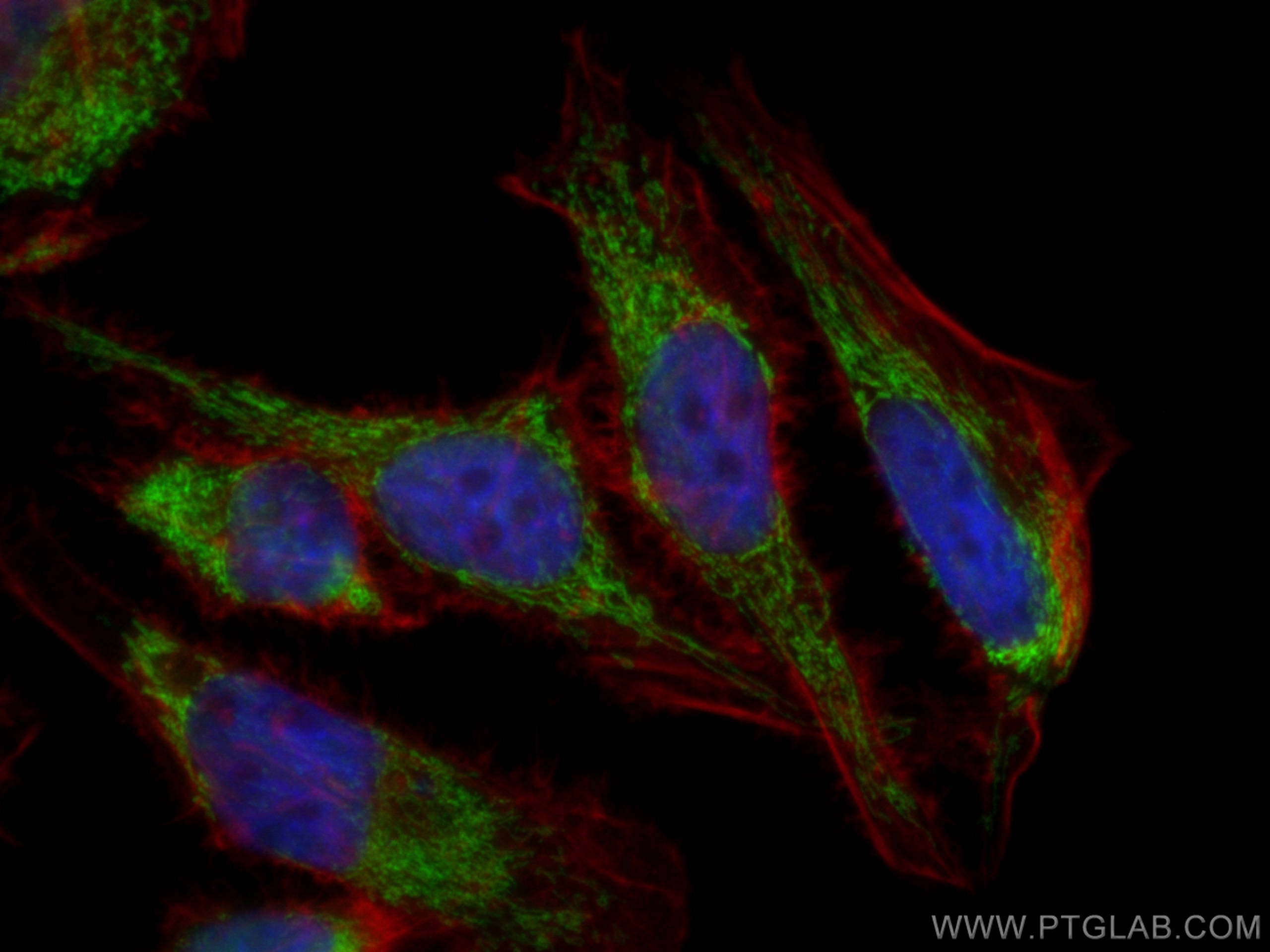 Immunofluorescence (IF) / fluorescent staining of HeLa cells using ETFA Polyclonal antibody (12262-1-AP)