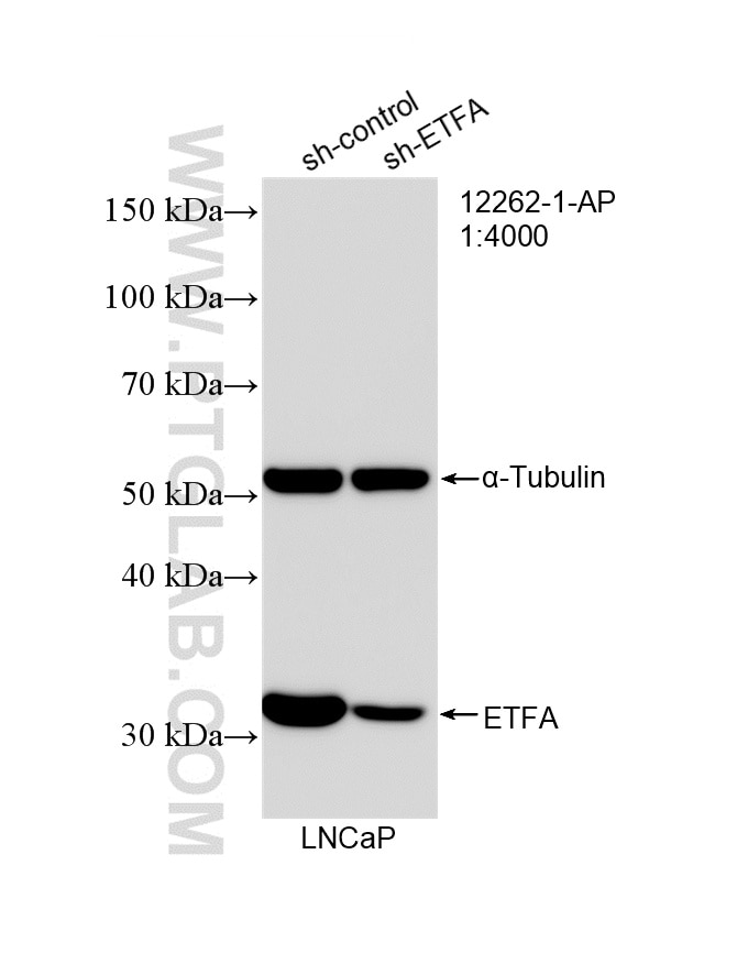 Western Blot (WB) analysis of LNCaP cells using ETFA Polyclonal antibody (12262-1-AP)