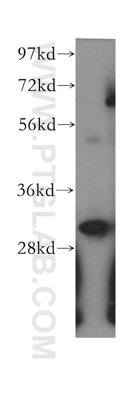 Western Blot (WB) analysis of human ileum tissue using ETFA Polyclonal antibody (12262-1-AP)