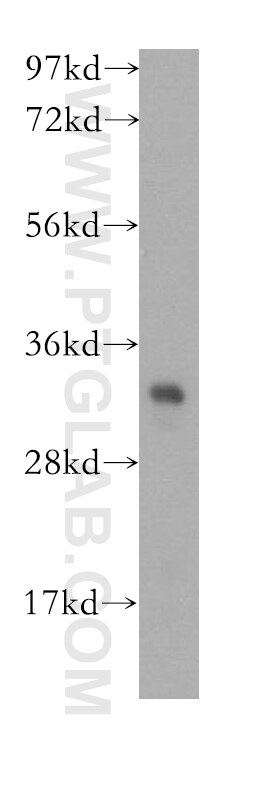 ETFA Polyclonal antibody