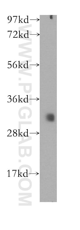 Western Blot (WB) analysis of Y79 cells using ETFA Polyclonal antibody (12262-1-AP)