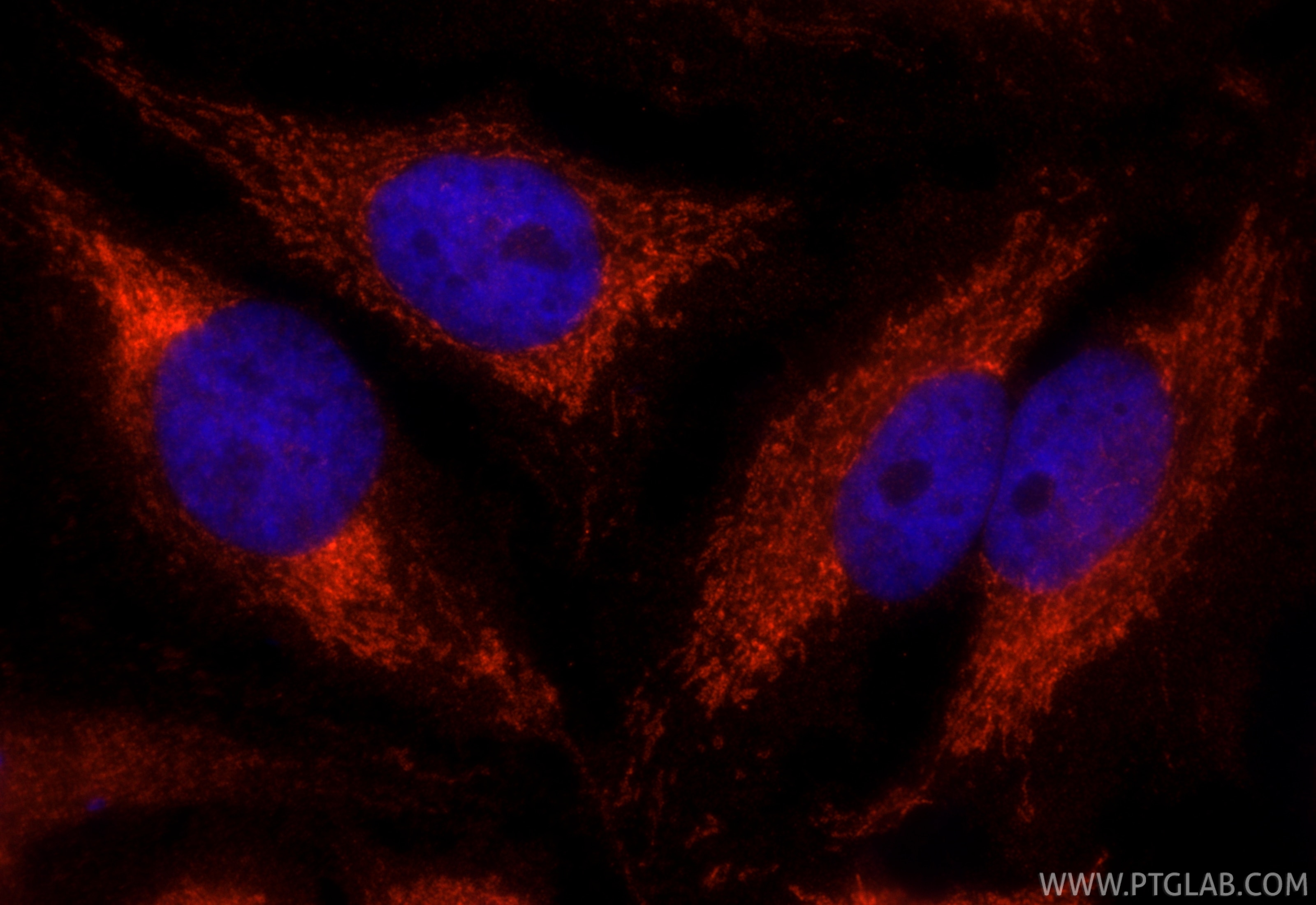 Immunofluorescence (IF) / fluorescent staining of HeLa cells using CoraLite® Plus 594-conjugated ETFA Monoclonal anti (CL594-67661)