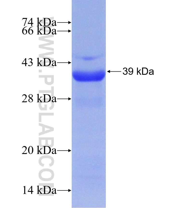 ETFA fusion protein Ag30257 SDS-PAGE