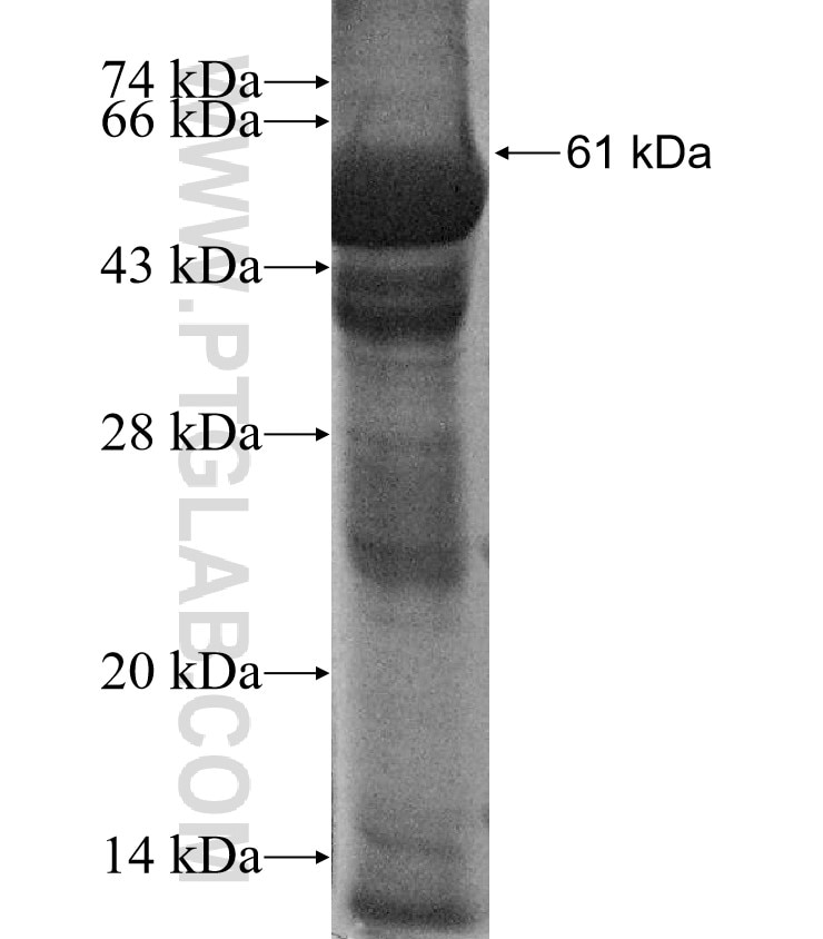 ETFA fusion protein Ag2931 SDS-PAGE
