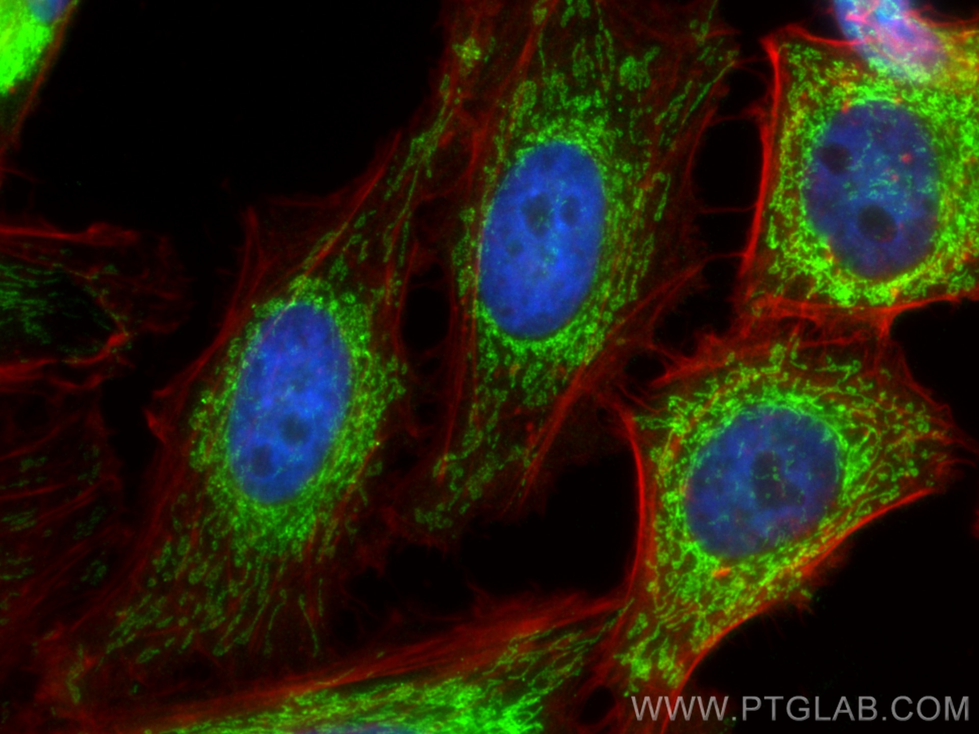 Immunofluorescence (IF) / fluorescent staining of HeLa cells using ETFB Polyclonal antibody (17925-1-AP)