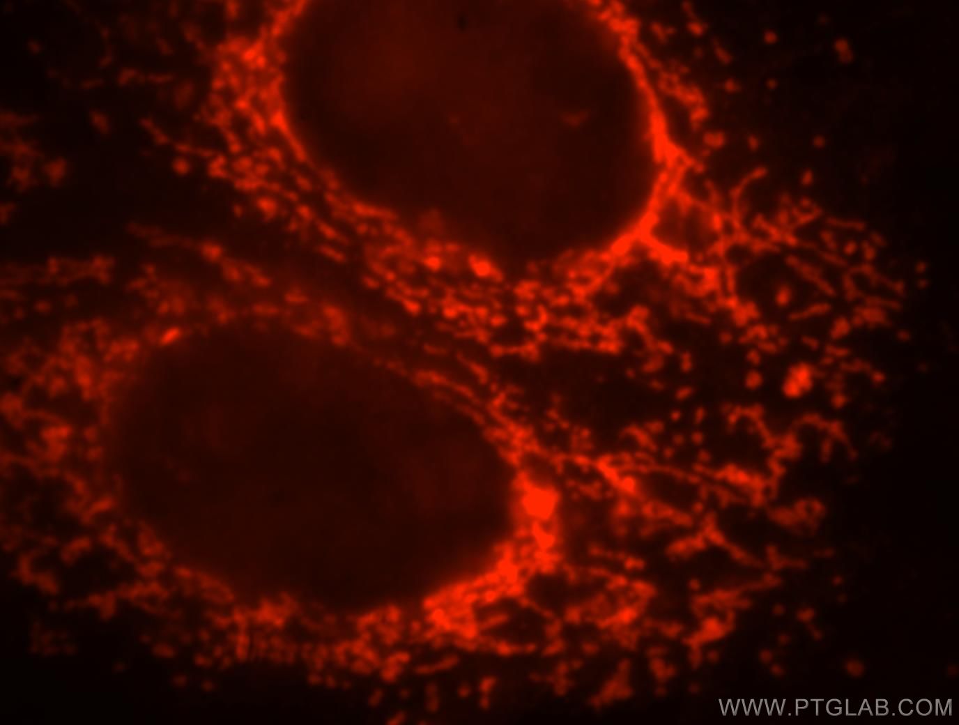 Immunofluorescence (IF) / fluorescent staining of HepG2 cells using ETFB Polyclonal antibody (17925-1-AP)