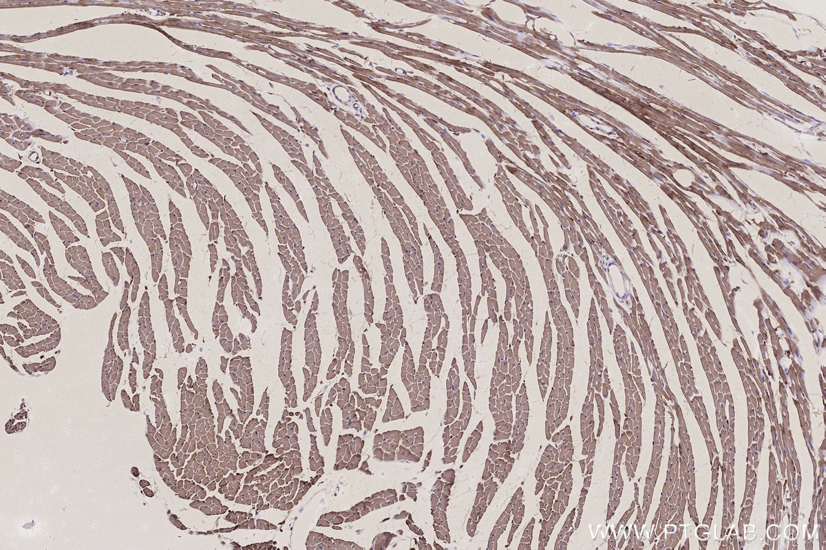 IHC staining of mouse heart using 17925-1-AP Immunohistochemistry (IHC) staining of mouse heart tissue using ETFB Polyclonal antibody (17925-1-AP)