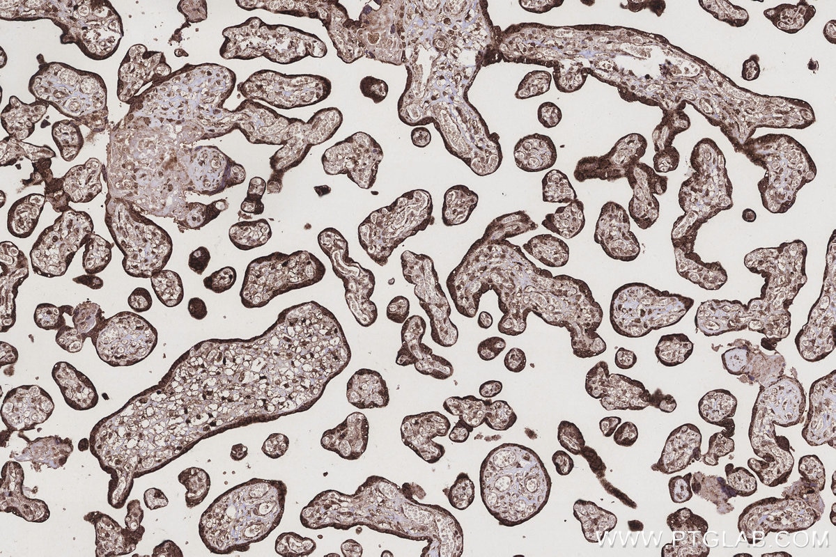 IHC staining of human placenta using 17925-1-AP Immunohistochemistry (IHC) staining of human placenta tissue using ETFB Polyclonal antibody (17925-1-AP)