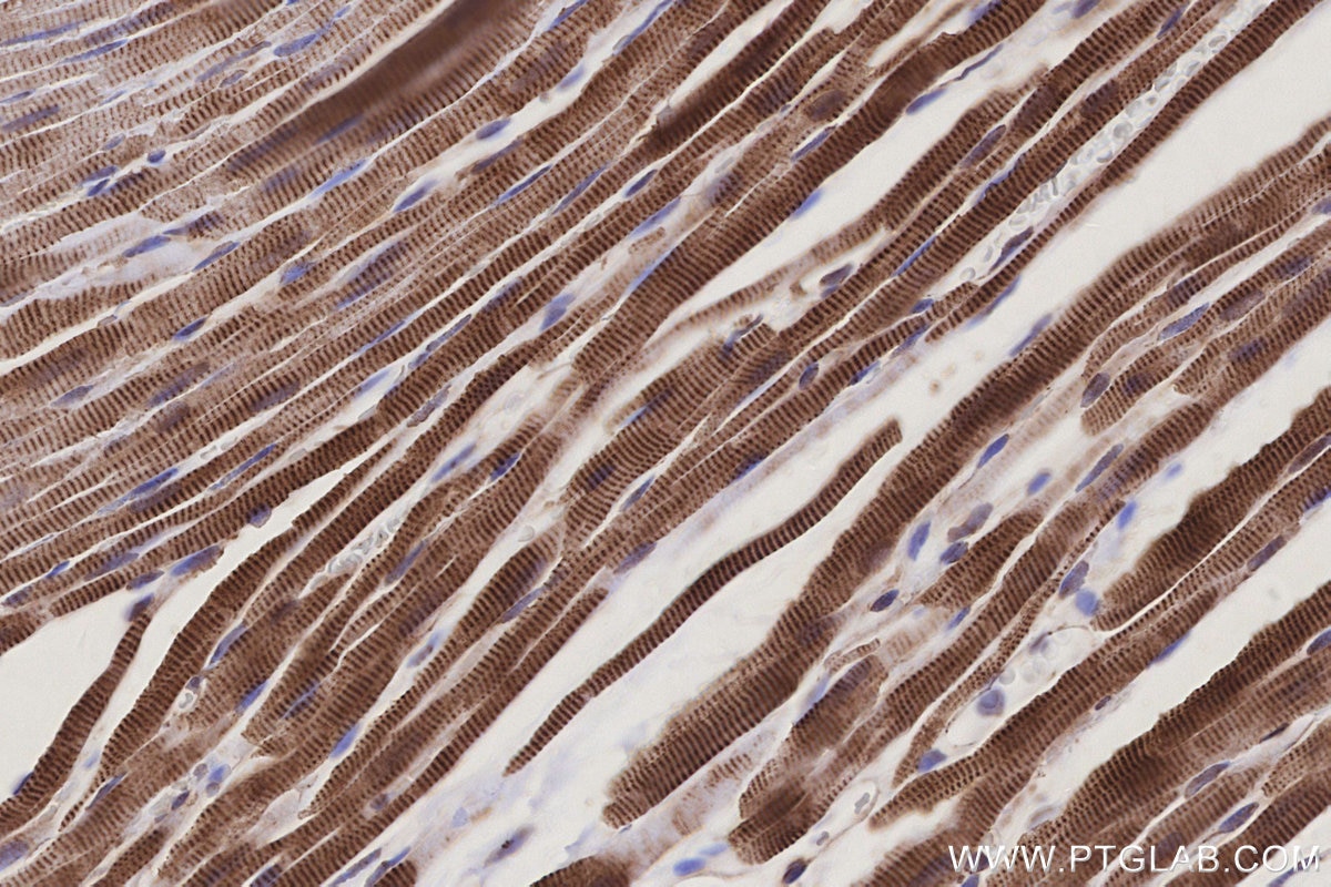 IHC staining of rat heart using 17925-1-AP Immunohistochemistry (IHC) staining of rat heart tissue using ETFB Polyclonal antibody (17925-1-AP)