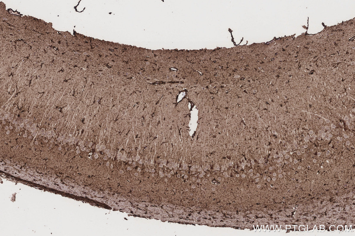 IHC staining of rat brain using 17925-1-AP Immunohistochemistry (IHC) staining of rat brain tissue using ETFB Polyclonal antibody (17925-1-AP)