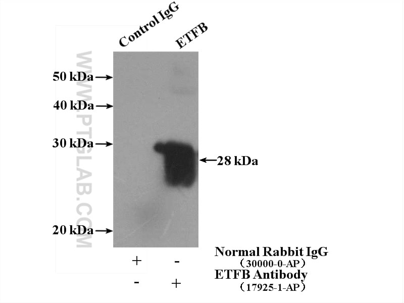 Immunoprecipitation (IP) experiment of mouse brain tissue using ETFB Polyclonal antibody (17925-1-AP)