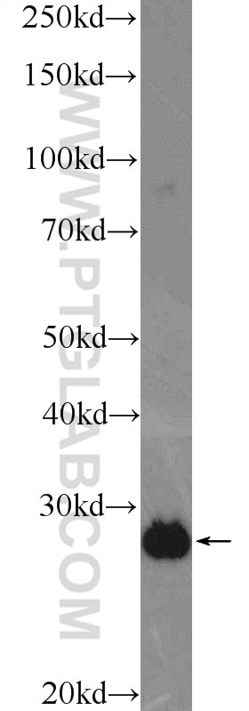 Western Blot (WB) analysis of mouse brain tissue using ETFB Polyclonal antibody (17925-1-AP)