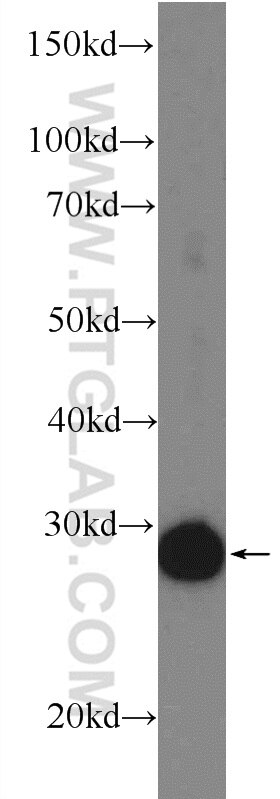 Western Blot (WB) analysis of mouse skeletal muscle tissue using ETFB Polyclonal antibody (17925-1-AP)