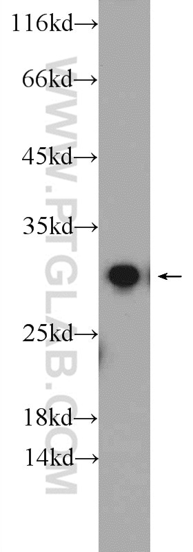 Western Blot (WB) analysis of mouse skeletal muscle tissue using ETFB Polyclonal antibody (17925-1-AP)