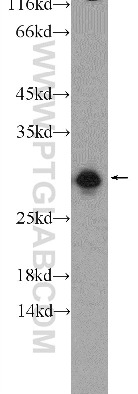 Western Blot (WB) analysis of rat brain tissue using ETFB Polyclonal antibody (17925-1-AP)