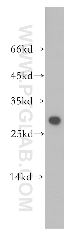 Western Blot (WB) analysis of mouse brain tissue using ETFB Polyclonal antibody (17925-1-AP)