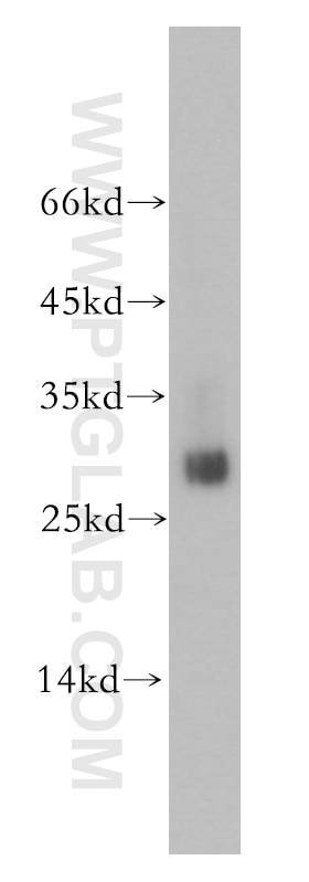 Western Blot (WB) analysis of human heart tissue using ETFB Polyclonal antibody (17925-1-AP)