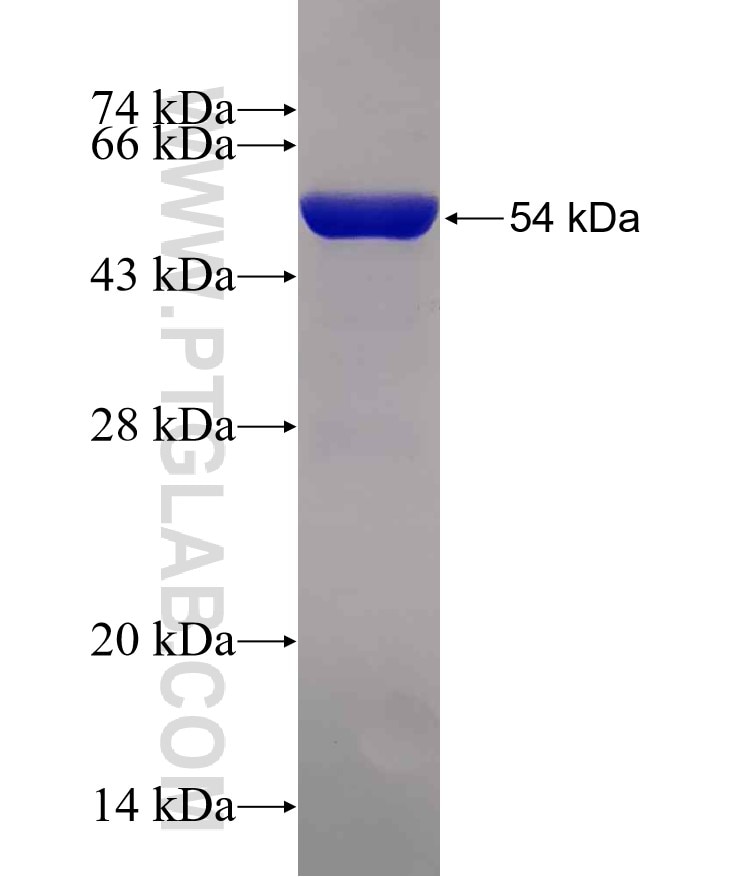 ETFB fusion protein Ag12344 SDS-PAGE