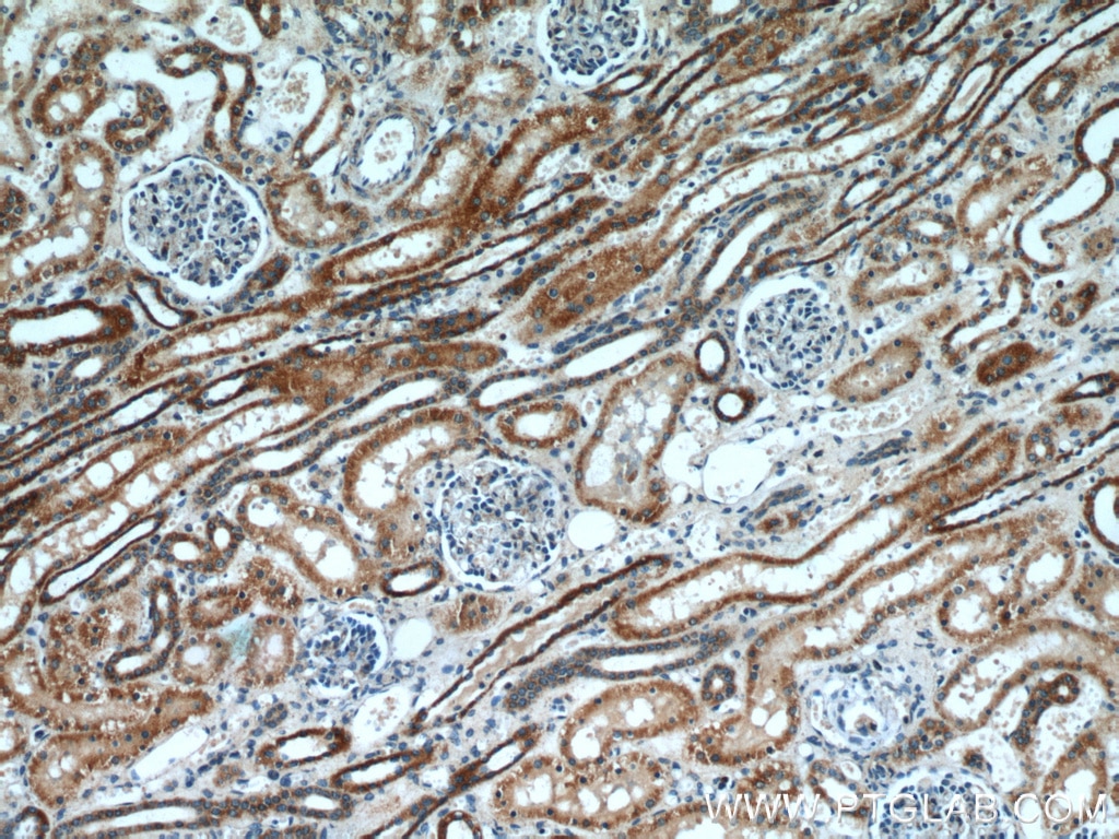 Immunohistochemistry (IHC) staining of human kidney tissue using ETFDH Polyclonal antibody (11109-1-AP)