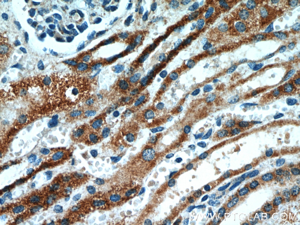 IHC staining of human kidney using 11109-1-AP