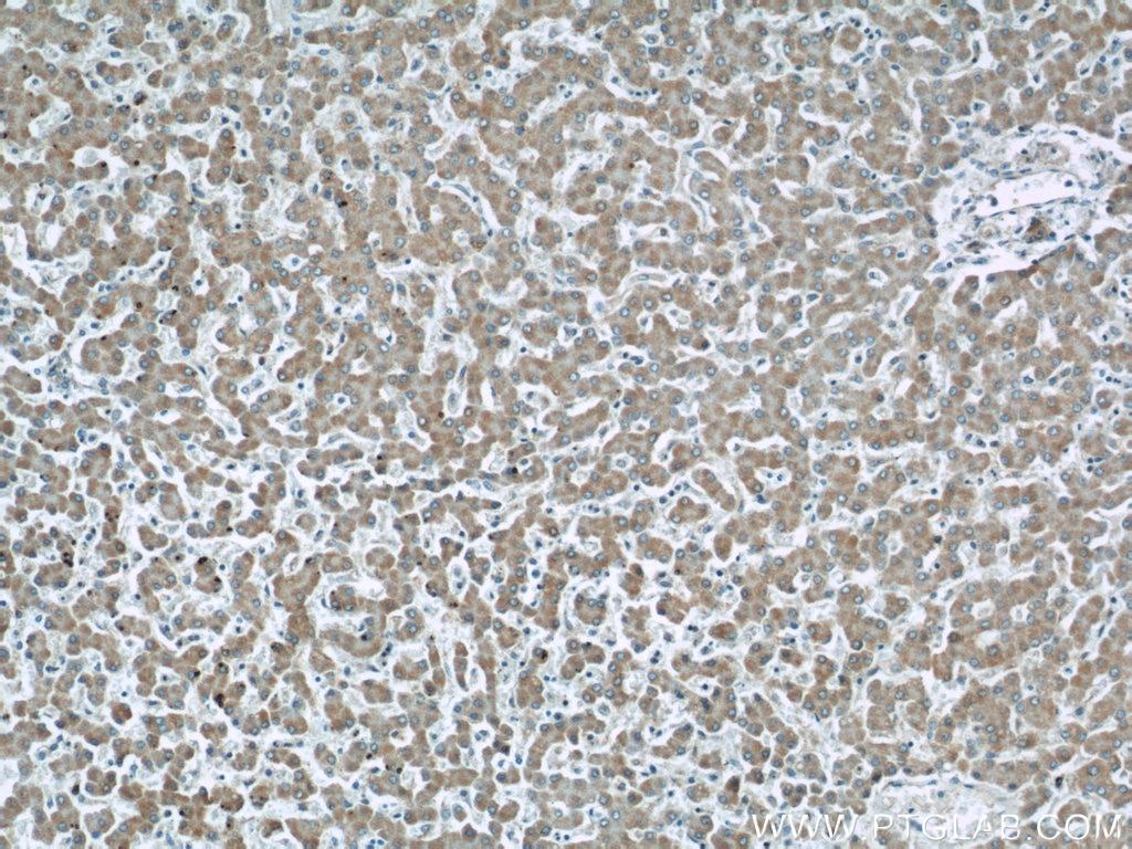 Immunohistochemistry (IHC) staining of human liver tissue using ETFDH Polyclonal antibody (11109-1-AP)