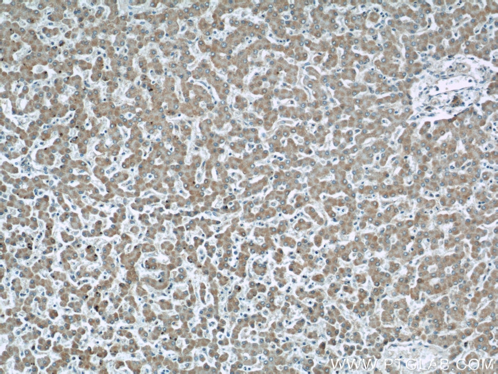 Immunohistochemistry (IHC) staining of human liver tissue using ETFDH Polyclonal antibody (11109-1-AP)