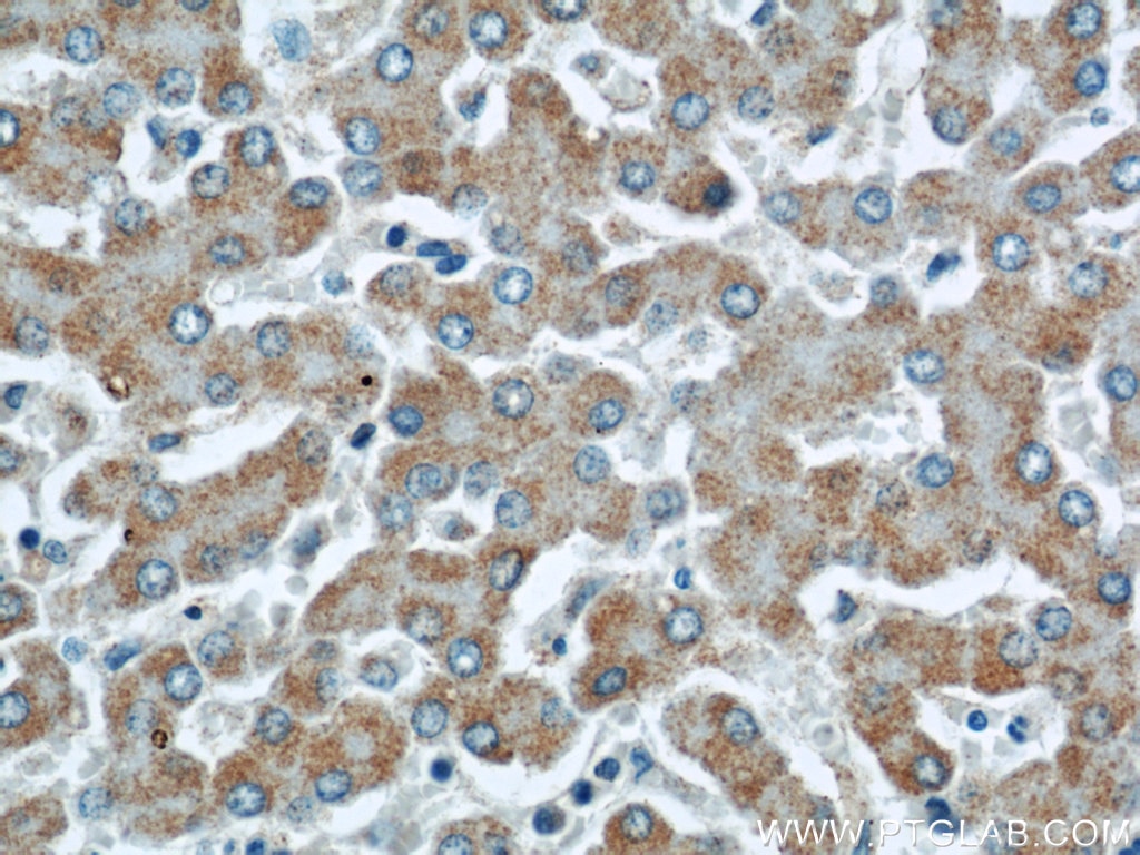 Immunohistochemistry (IHC) staining of human liver tissue using ETFDH Polyclonal antibody (11109-1-AP)