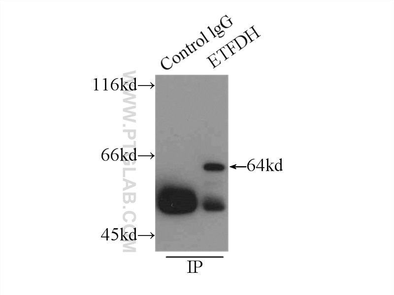 Immunoprecipitation (IP) experiment of mouse brain tissue using ETFDH Polyclonal antibody (11109-1-AP)