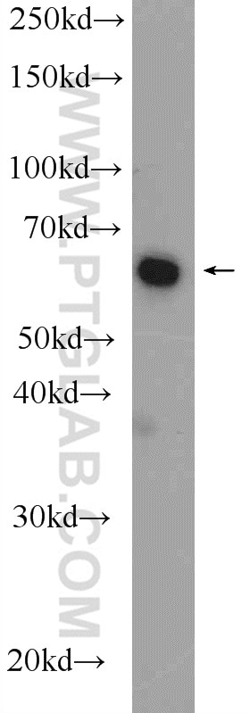 Western Blot (WB) analysis of rat brain tissue using ETFDH Polyclonal antibody (11109-1-AP)