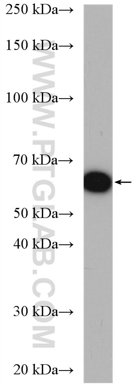 Western Blot (WB) analysis of mouse kidney tissue using ETFDH Polyclonal antibody (11109-1-AP)