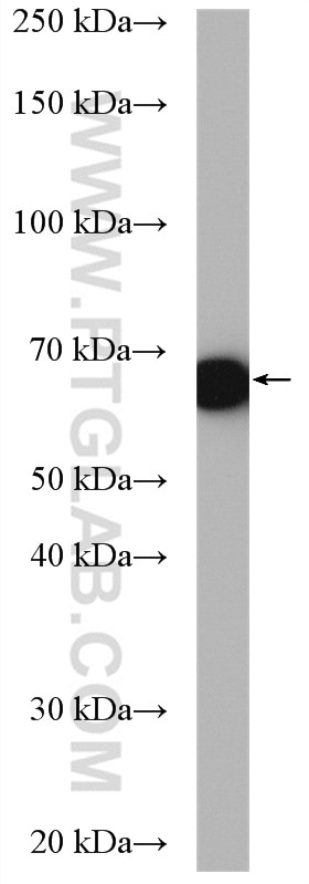 Western Blot (WB) analysis of mouse skeletal muscle tissue using ETFDH Polyclonal antibody (11109-1-AP)