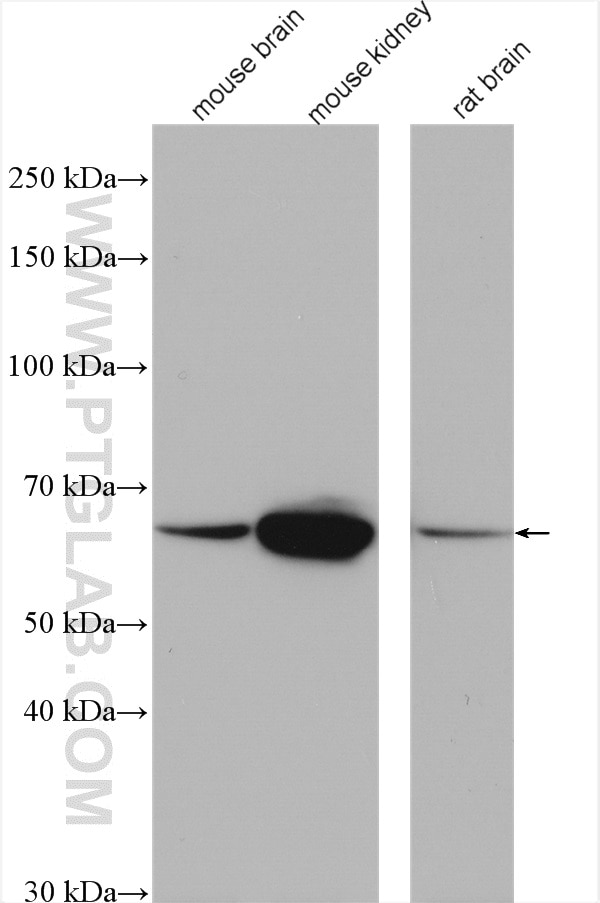 Western Blot (WB) analysis of various lysates using ETFDH Polyclonal antibody (11109-1-AP)