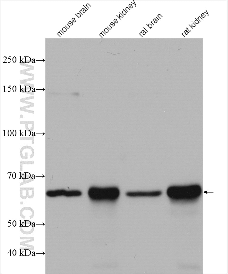 Western Blot (WB) analysis of various lysates using ETFDH Polyclonal antibody (11109-1-AP)