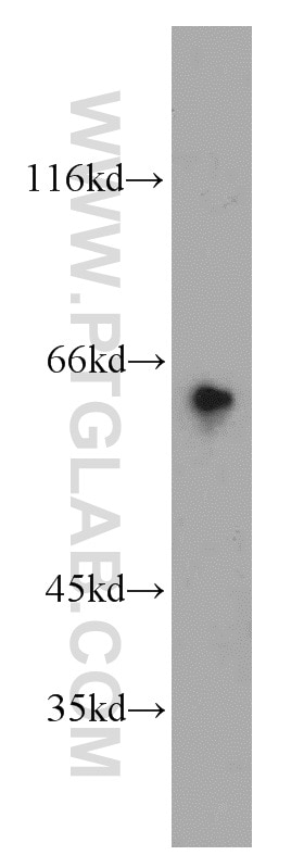Western Blot (WB) analysis of HEK-293 cells using ETFDH Polyclonal antibody (11109-1-AP)