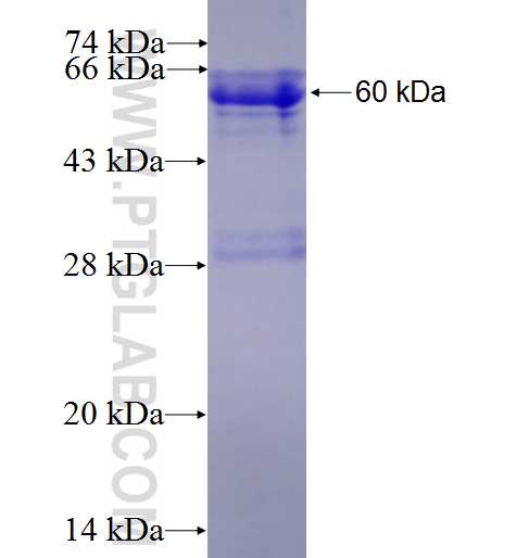 ETFDH fusion protein Ag1568 SDS-PAGE