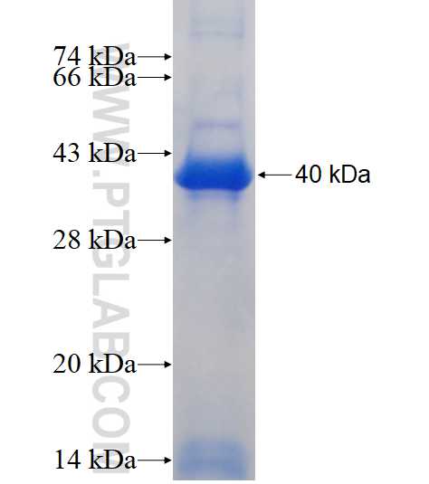 ETFDH fusion protein Ag17921 SDS-PAGE
