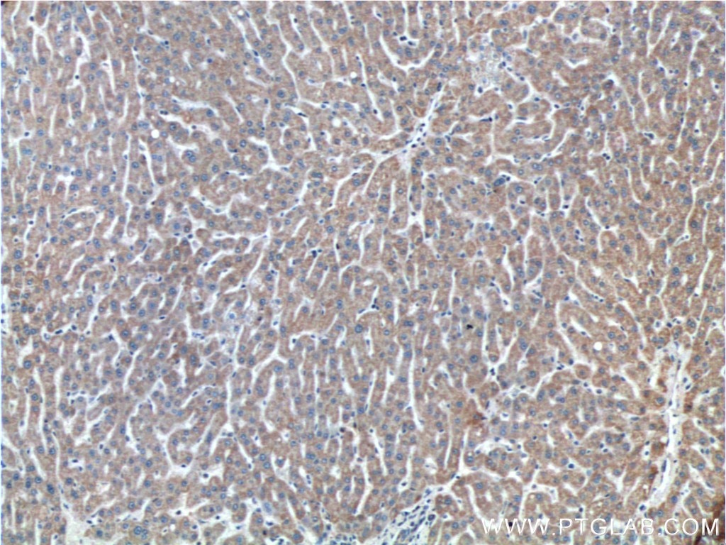 Immunohistochemistry (IHC) staining of human liver tissue using ETHE1 Polyclonal antibody (27786-1-AP)