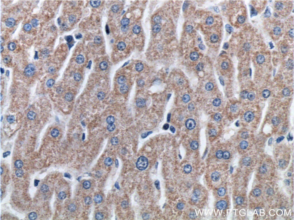 Immunohistochemistry (IHC) staining of human liver tissue using ETHE1 Polyclonal antibody (27786-1-AP)