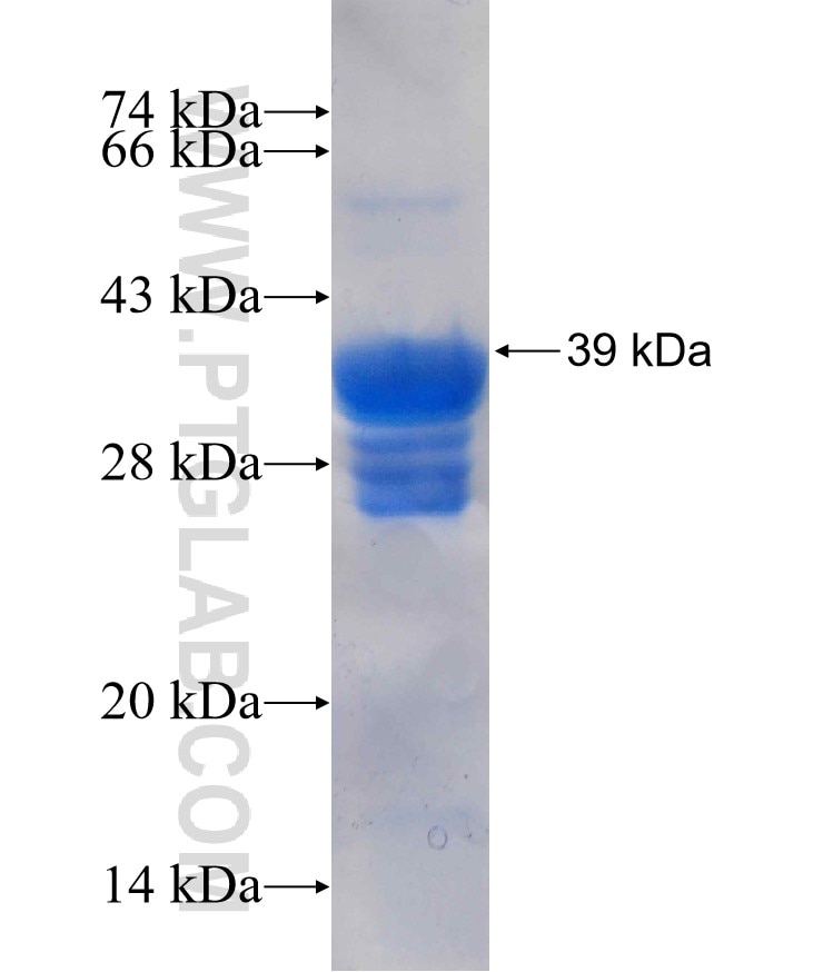 ETHE1 fusion protein Ag26597 SDS-PAGE