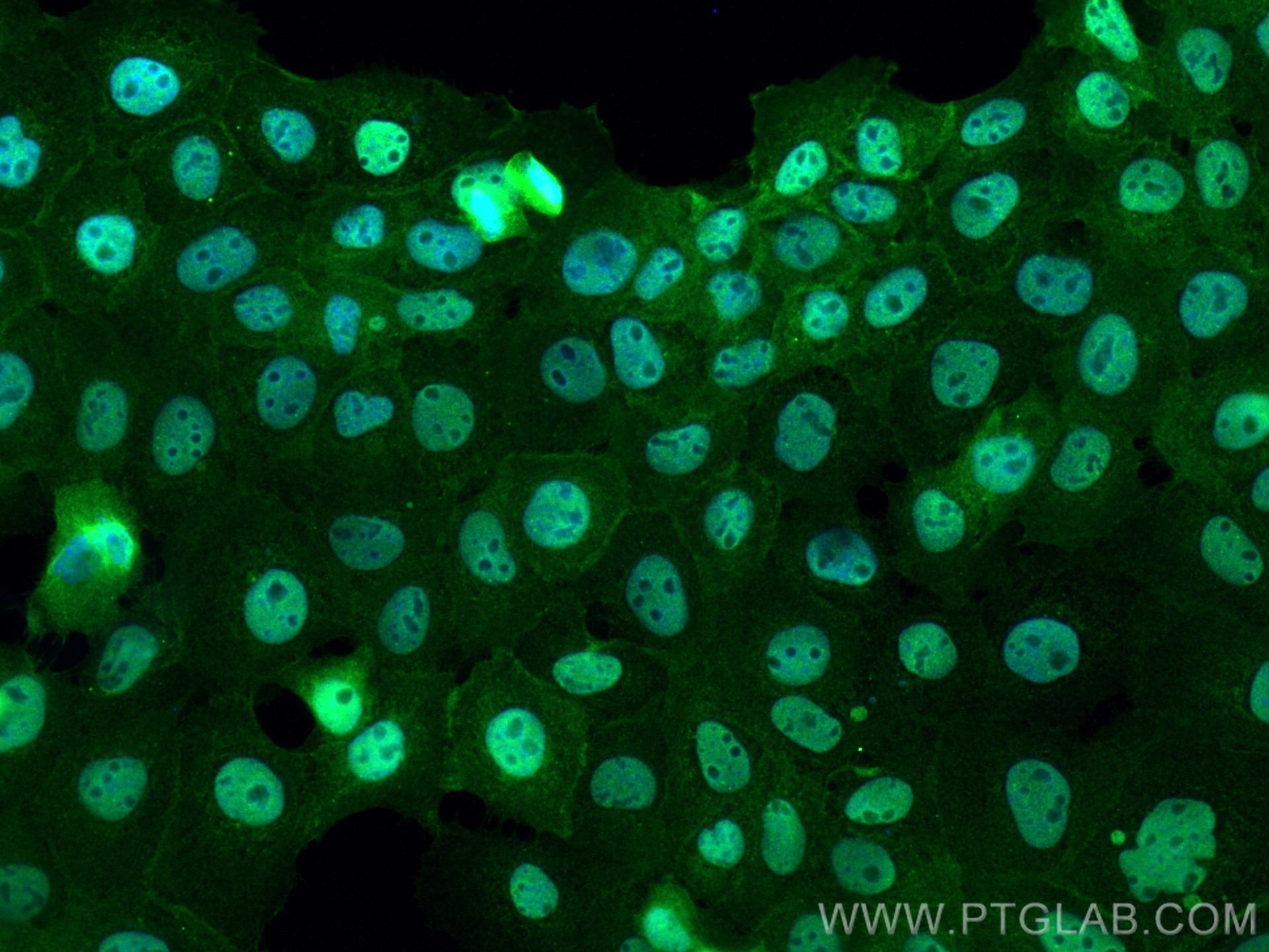 Immunofluorescence (IF) / fluorescent staining of A431 cells using ETS1 Polyclonal antibody (12118-1-AP)