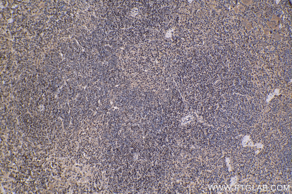 IHC staining of mouse spleen using 12118-1-AP