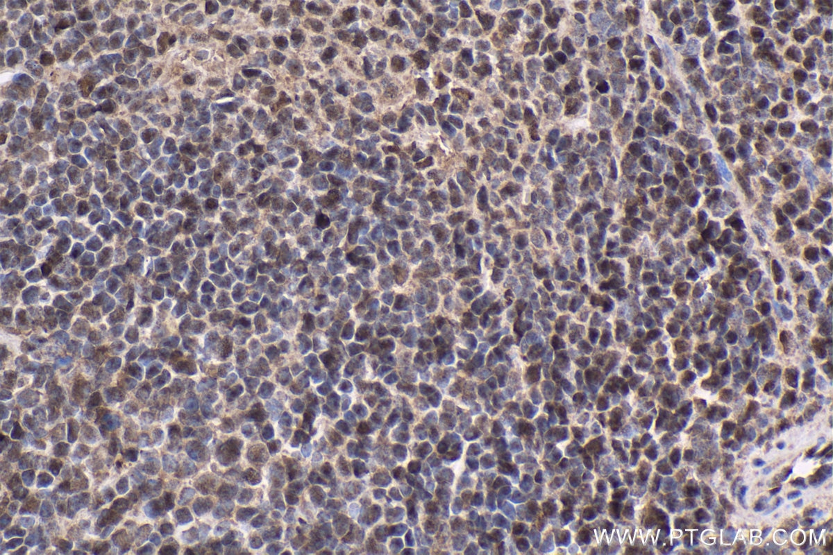 Immunohistochemistry (IHC) staining of mouse spleen tissue using ETS1 Polyclonal antibody (12118-1-AP)