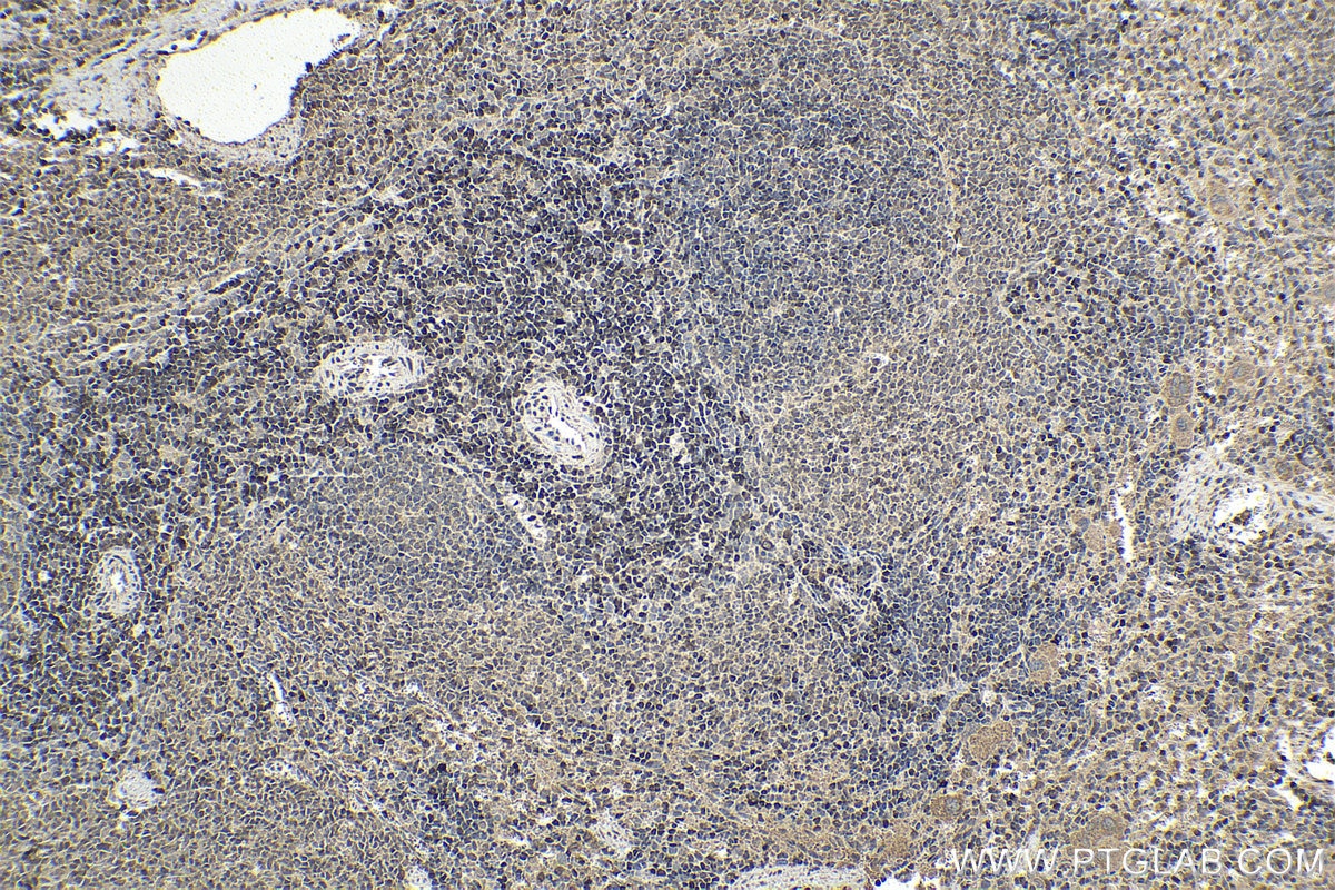 Immunohistochemistry (IHC) staining of rat spleen tissue using ETS1 Polyclonal antibody (12118-1-AP)
