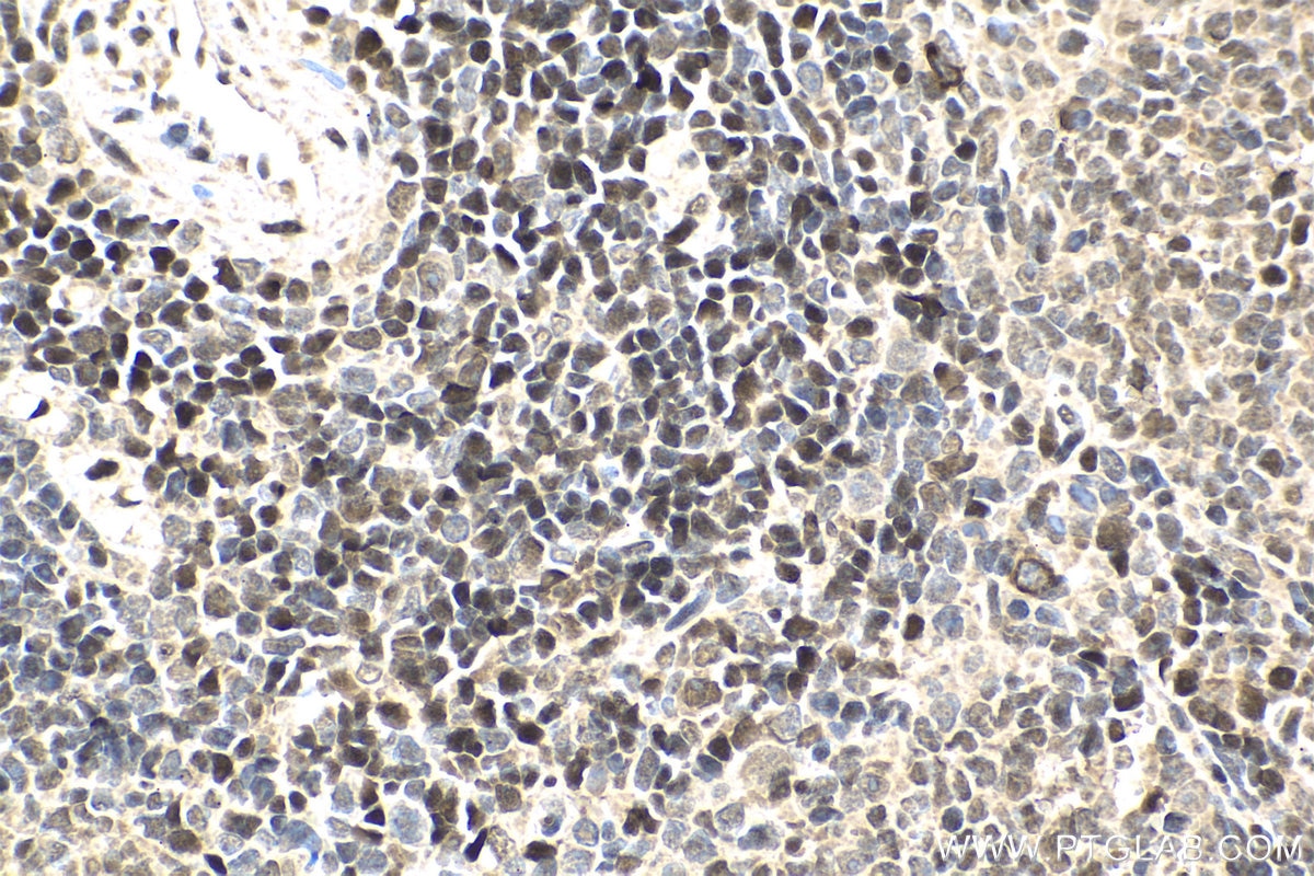Immunohistochemistry (IHC) staining of rat spleen tissue using ETS1 Polyclonal antibody (12118-1-AP)