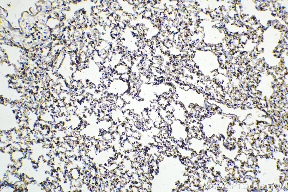 IHC staining of rat lung using 12118-1-AP
