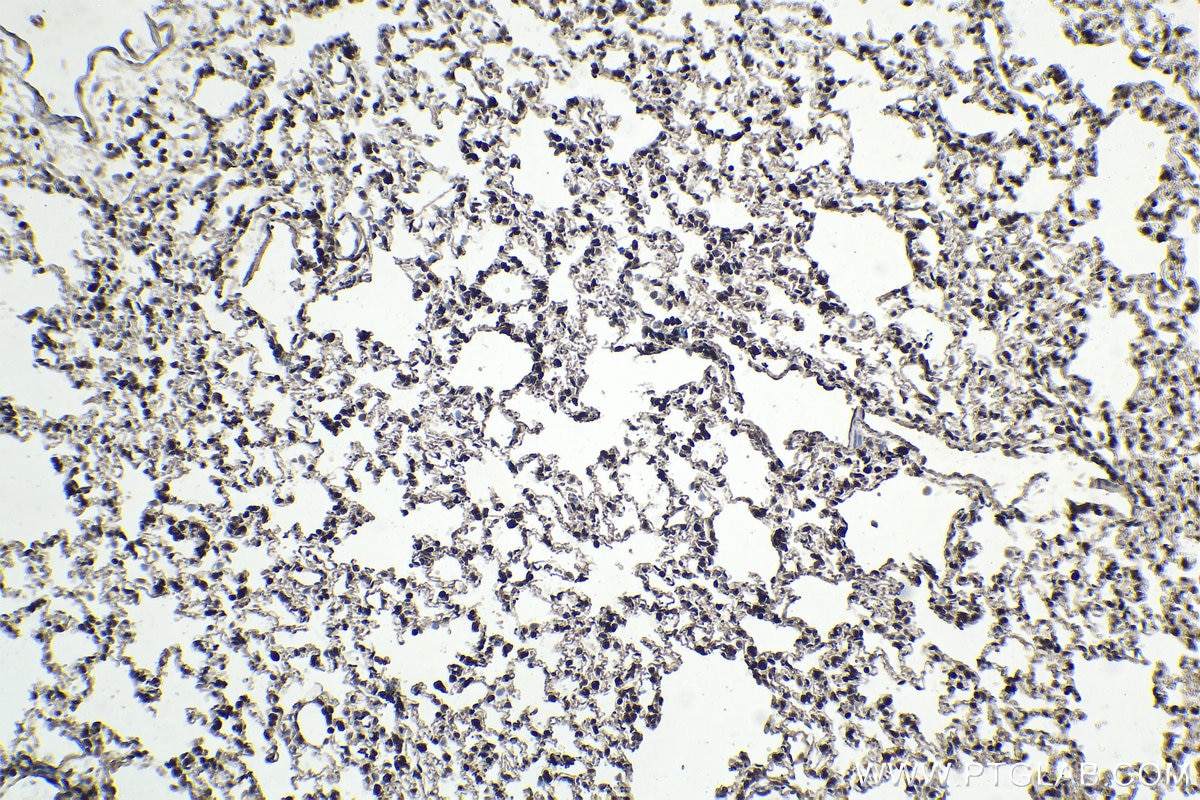 Immunohistochemistry (IHC) staining of rat lung tissue using ETS1 Polyclonal antibody (12118-1-AP)