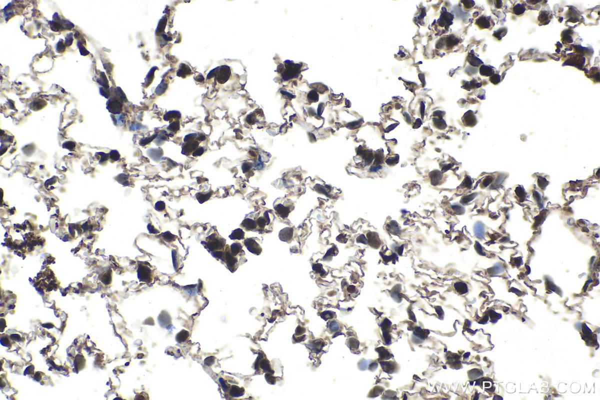 Immunohistochemistry (IHC) staining of rat lung tissue using ETS1 Polyclonal antibody (12118-1-AP)